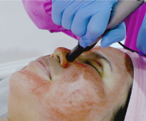 Growth Factor Rejuve